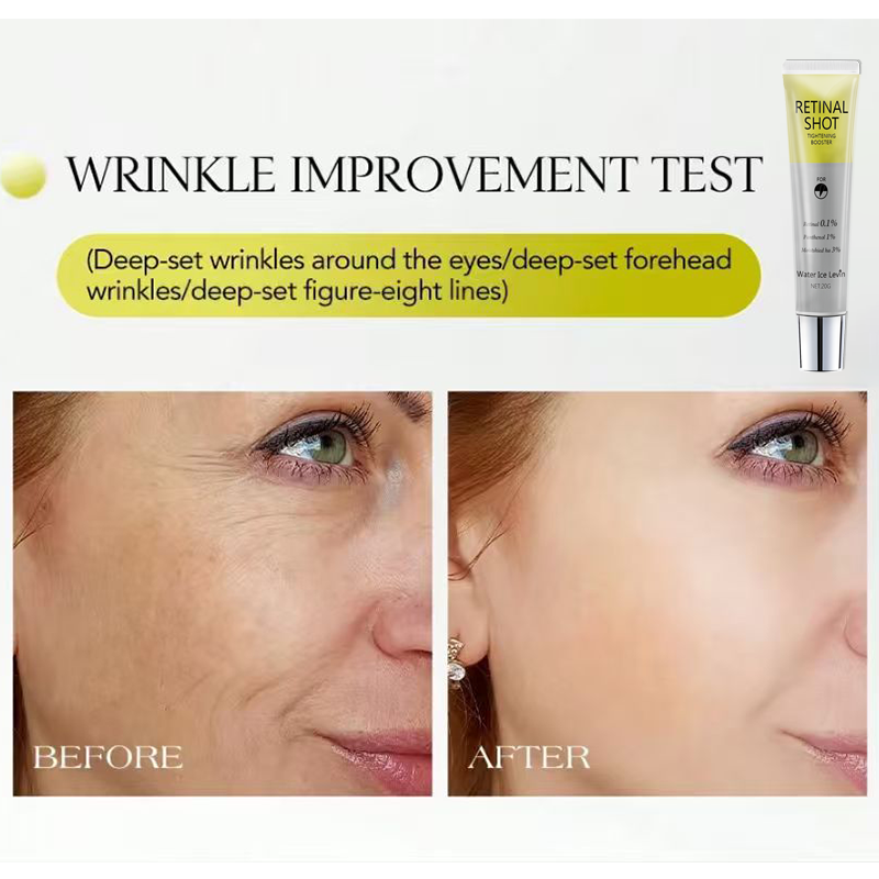 Retinal 0.1% Intensive Shot Pa - Niacinamide Brightening Serum review and price