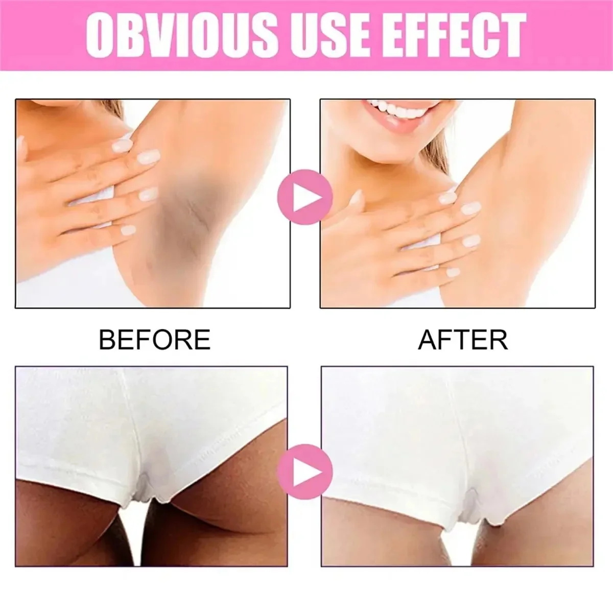 Whitening Cream Private Parts  - Niacinamide Brightening Serum review and price